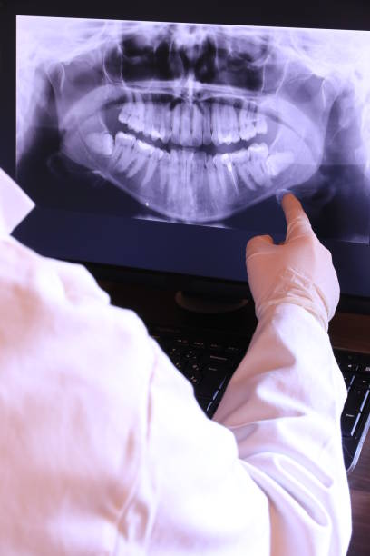 Best Emergency Root Canal Treatment in University, MS
