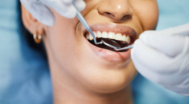 Best Urgent Care for Lost Fillings or Crowns in University, MS