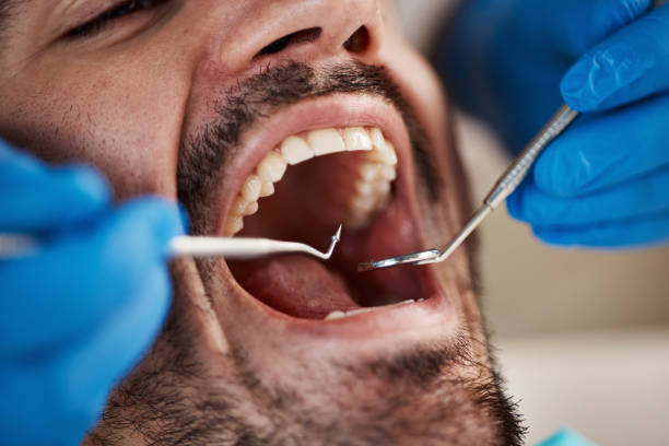 Best Same-Day Emergency Dental Services in University, MS