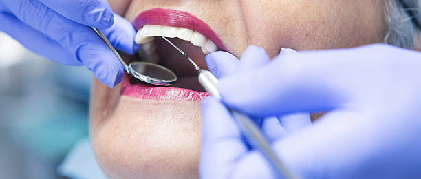 Best Emergency Dental Care for Broken or Chipped Teeth in University, MS